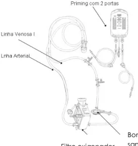 Figura 1. Circuito extra-corporal 