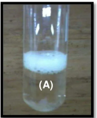 Figura  7:  Resultado  do  teste  de  espuma  com  extrato  aquoso  foliar  de  Plukenetia 