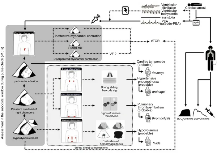 Figure 15 Cardiopulmonaryresuscitation diagnosis algorithm.