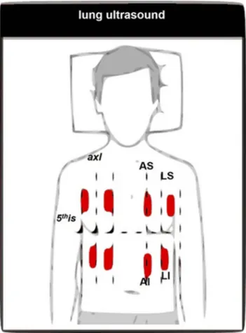 Figure 2 Systematic approach for lung ultrasound probe placement locations.