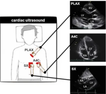 Figure 9 Systematic approach for cardiac ultrasound placement locations.