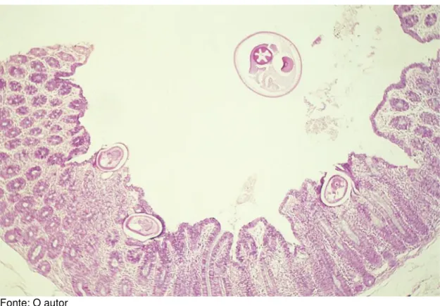 Figura 4 - Fotomicrografia de lâmina histológica de um corte transversal  de Trichuris trichiura associada com o tecido cecal