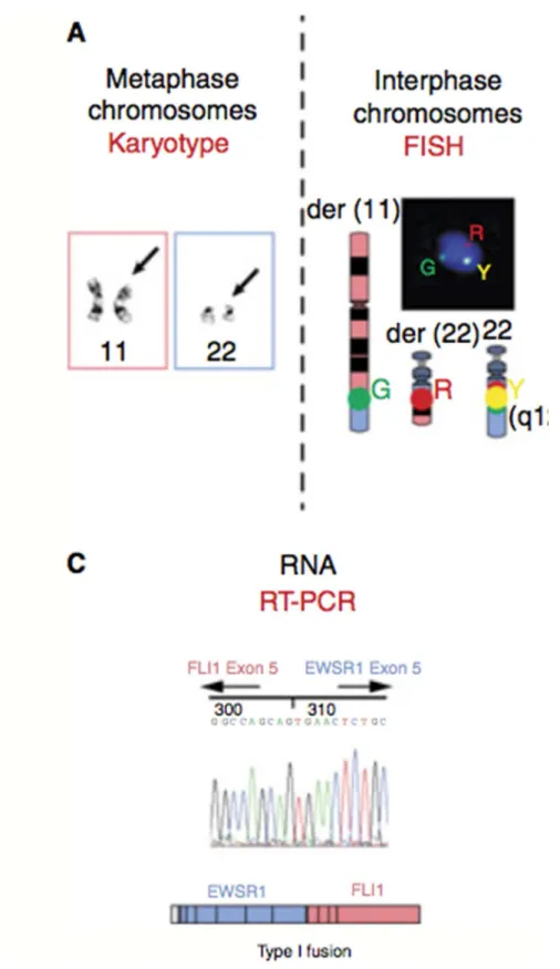 Figura 1 – Técnicas Utilizadas para detectar características genéticas (30)  A – Citogenética Clássica  B – FISH  C - RT-PCR  