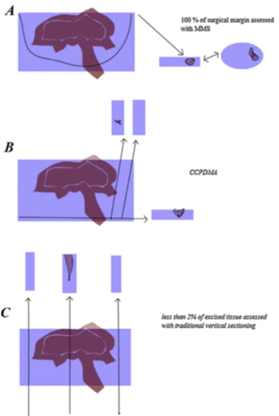 Fig. 2 – Várias técnicas de processamento das peças cirúrgicas (61) 