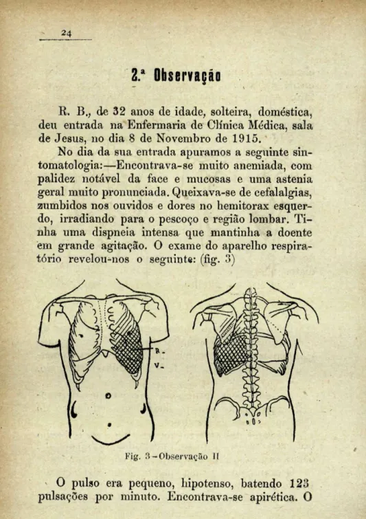 Fig. 3-Observação II 