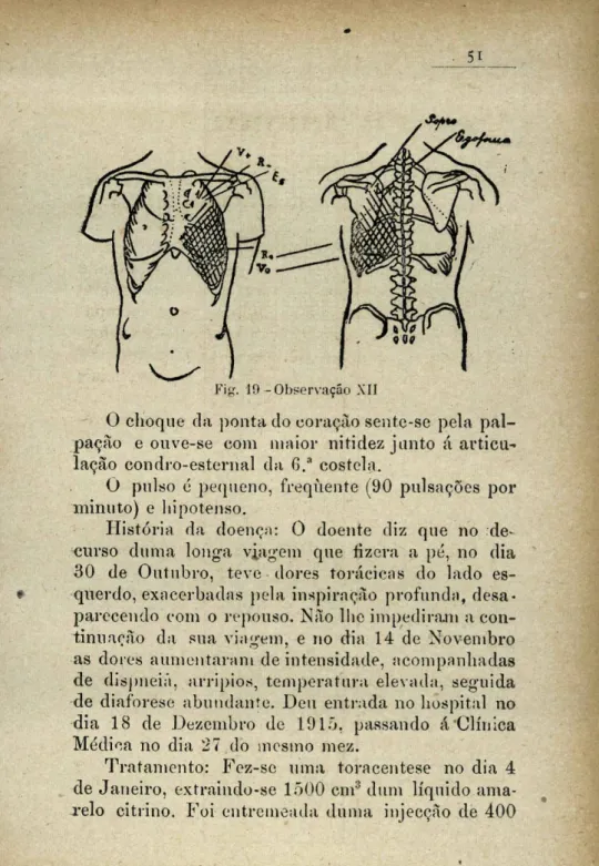 Fig. 19 -Observação XII 