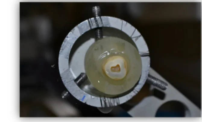 Figure 4: First cut 1-2 mm below the CEJ.            Figure 5: Pulp chamber’s exposure