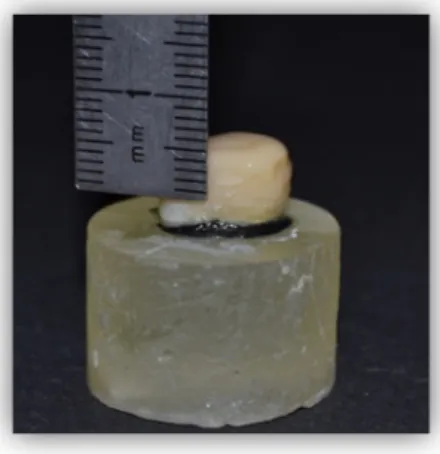 Figure 14: Resin composite ENAMEL plus         HRi. 