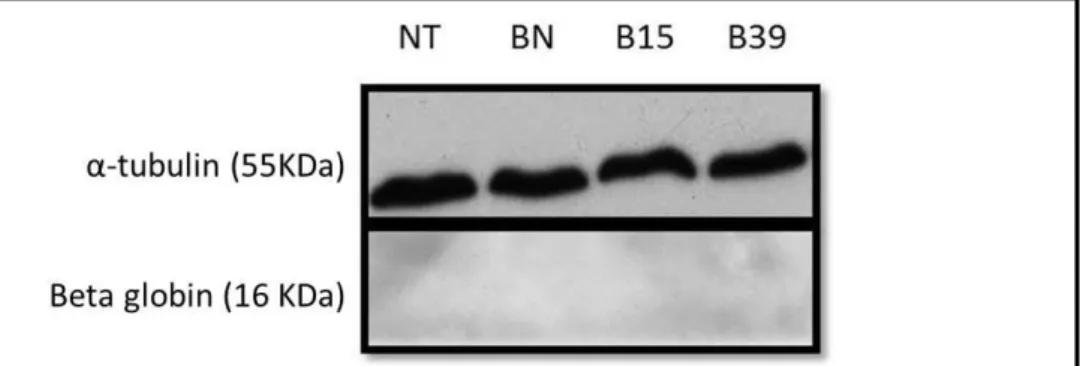 Figure  3:  Western  blot  of  cell  lysates  using  an  anti-beta  globin  antibody  (Sigma-Aldrich®)