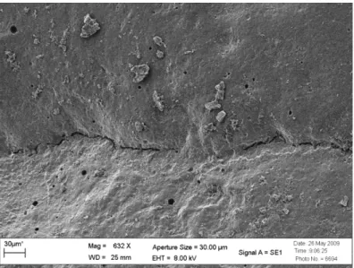 Fig.  2.3  -  Margens  da  Resina  Esthet-x  após  12  meses,  classificando  as  fendas  marginais