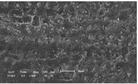 Figura 3.11  – Microfotografia da fibra de coco babaçu tratada (5,0%   NaOH)  