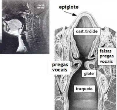 Figura 2.2 - Secções da laringe. Adaptado de [1]. 
