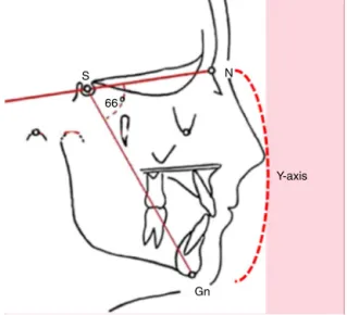 Figure 2 Y-axis of facial growth (represented by the opening of the NS-Gn angle).