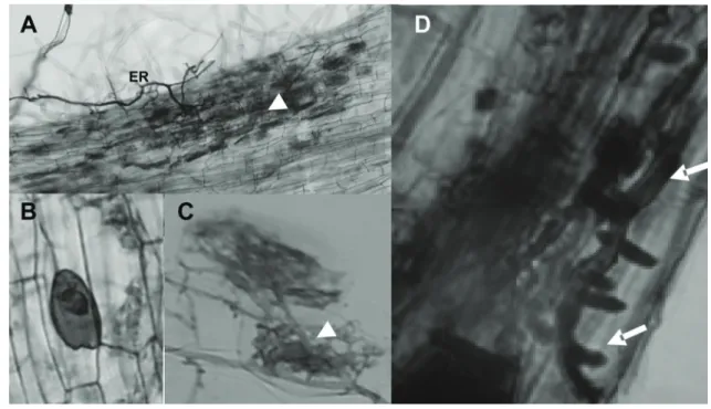 figure 1. Functional mycorrhizal structures in roots of the plant host Solanum lycopersicum  (Tomato)