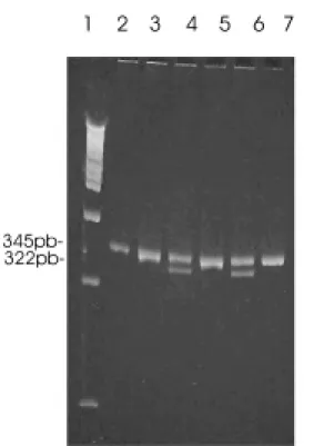 Figura 2 - Identificação da mutação C677T da metileno-tetrai- metileno-tetrai-drofolato redutase por PCR