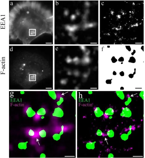 Figure  3.1  -  Comparison  between  conventional  epifluorescence  microscopy  and  dSTORM 