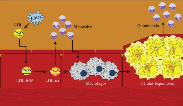 Figura 3. Processo de formação da placa aterosclerótica. O LDL sofre oxidação gradual até a formação do LDL minimamente  modificado (LDL-MM), que pode conter produtos oxidativos de lipídios sem modificação proteica