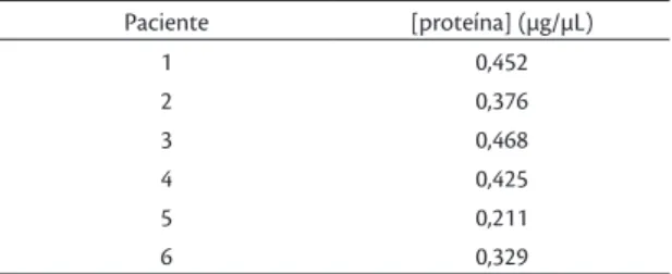 Tabela 1. Concentração proteica das amostras.