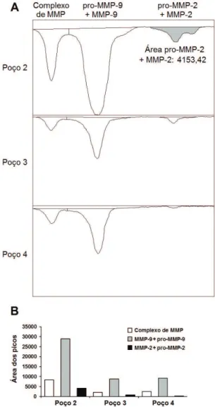 Figura 3 . Quantiicações das metaloproteinases (MMPs)  em um dos géis analisados.  A: curvas densitométricas (picos  invertidos) das bandas em cada poço do gel