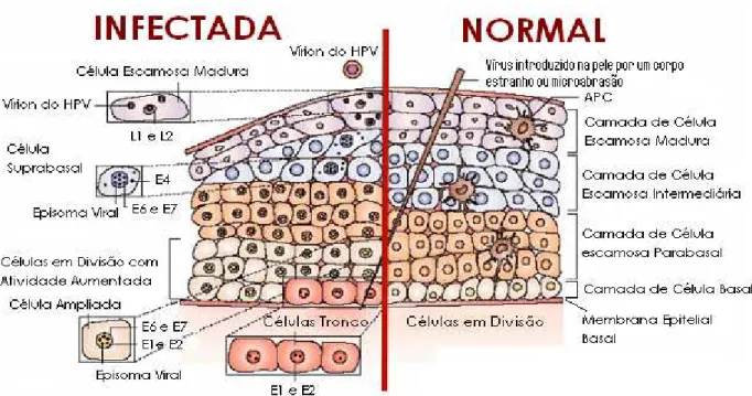 Figura  2  -  Replicação  do  HPV  relacionada  à  diferenciação  das  células  do  epitélio  escamoso  estratificado da cérvice uterina mostrando um epitélio cervical normal e um infectado pelo vírus  HPV (Adaptado de MUÑOZ et al., 2006)