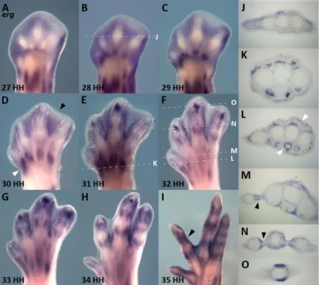 Figure  6  –  erg  expression  during  digit  development.  In  situ  hybridization  for  erg  in  developing  autopods at stages 27HH (A), 28HH  (B),  29  HH  (C),  30HH  (D),  31HH (E),  32HH  (F),  33HH  (G),  34HH  (H)  and  34HH (I)
