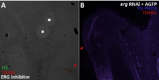 Figure 11 – TUNEL apoptotic cell labeling of experimental interdigits after  erg inhibition
