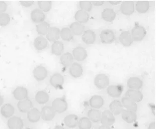 Figure  2:  Photomicrograph  of  blood  smear  from  blood  samples  treated  with  saline  (control)