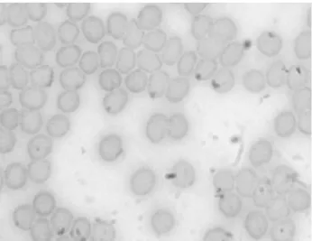 Figure  3:  Photomicrograph  of  blood  smear  from  blood  samples  treated  with  TB  extract