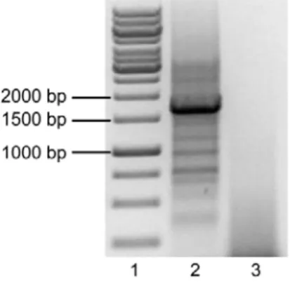 Figure 10 – Agarose gel at 1% showing the PCR reaction of pECE.HA- pECE.HA-FOXO3a.A3.  Lane 1 – Molecular weight marker