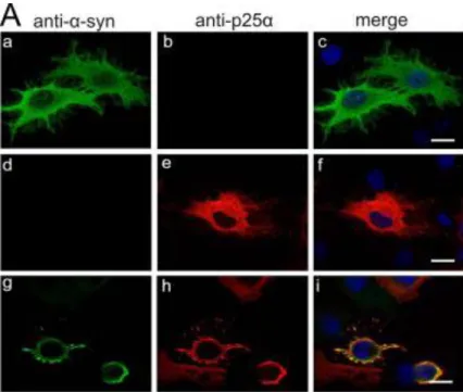 Figure  7.  Retraction  of  cellular  processes  in  oligodendroglial  glial  co-expressing  aSyn  and  p25