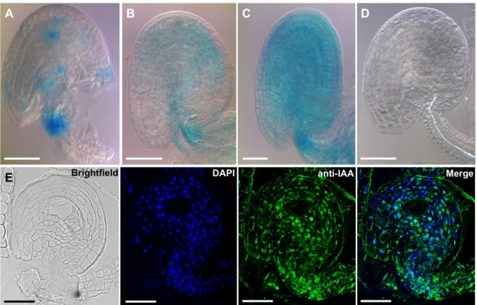 Figure 3-1 GH3.3pro:GUS expression pattern and IAA immunolocalization in unfertilized ovules