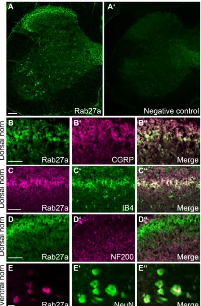 Figure 2. Rab27a localization in the spinal cord. (A) Immunostaining experiments detected Rab27a in  the dorsal horn and  in  some ventral horn neurons. No specific  signal  was  detected by  omitting the  primary  antibody  (A’,  negative  control).  (B–D