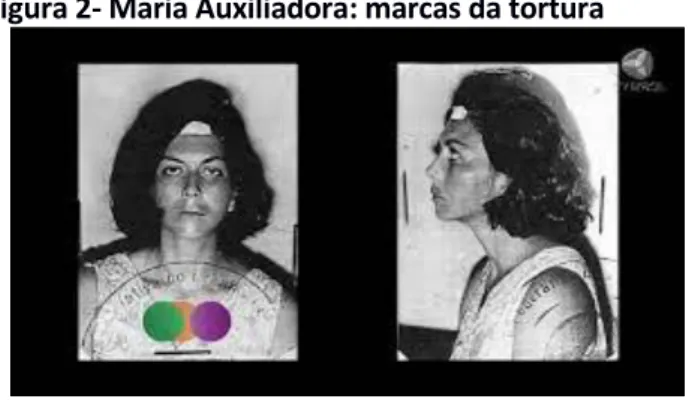 Figura 2- Maria Auxiliadora: marcas da tortura 