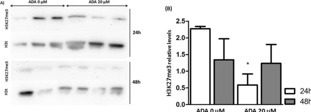 Figure 8. Effect of excess of SAH on H3K27me3 mark in HUVEC.  