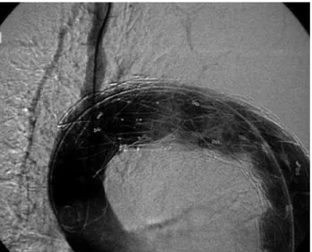 Figura 6 - Imagem fotográfica de peça de anatomia patológica de