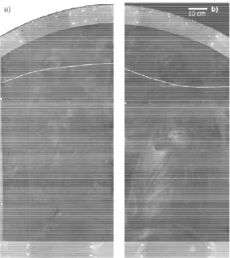 Figura 10: Radiografias digitais