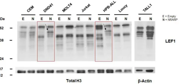 Figure 3.7 – Effects of NRARP overexpression on LEF1 protein expression. LEF1 protein expression profile in T- T-ALL cell lines overexpressing NRARP (comparing with Empty), determined by Western Blot