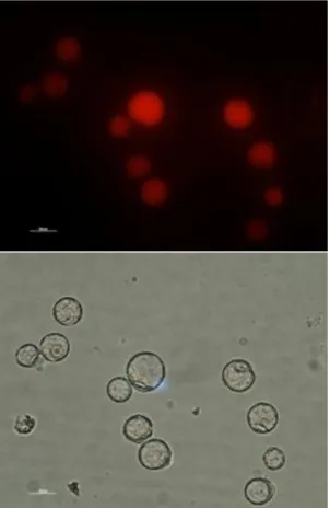 Figure 7 - Protoplasts of pB7RWG2.0 culture. In these photos it is clear that the  RFP gene is being transcribed and translated into the RFP protein