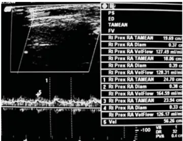 Figura 1 - Posição do paciente para avaliação da fístula arte-