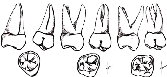 Figura 5- Dentes 18, 17 e 16 (adaptado de Jean-Pol Beauthier, 2011) 
