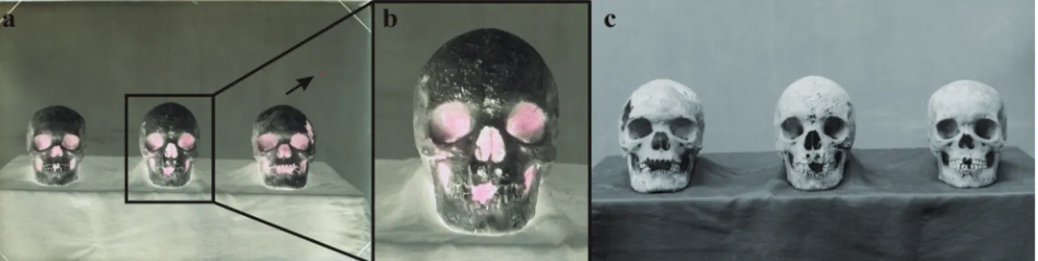 Figure 4.- Osteology, three skulls, frontal view: a) negative; b) detail of the area highlighted in a, showing partial fingerprints; c) detail,  positive image obtained with digital tools.