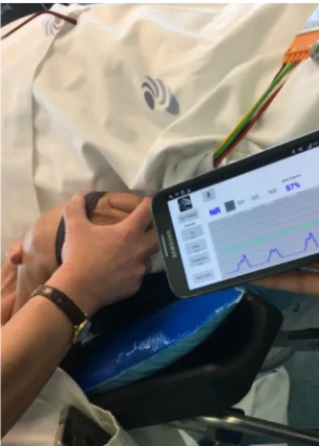 Figure 5. Real-time wrist rigidity improvement classification during the DBS surgery performed  using iHandU 4.0 and the most recent wearable device in Centro Hospitalar Universitário São João,  E.P.E., Porto, Portugal