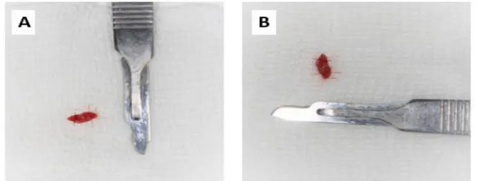 Figura 2. A e B- Fragmentos de biópsia incisional. Fonte: acervo da clínica de estomatologia  da Universidade Federal do Ceará