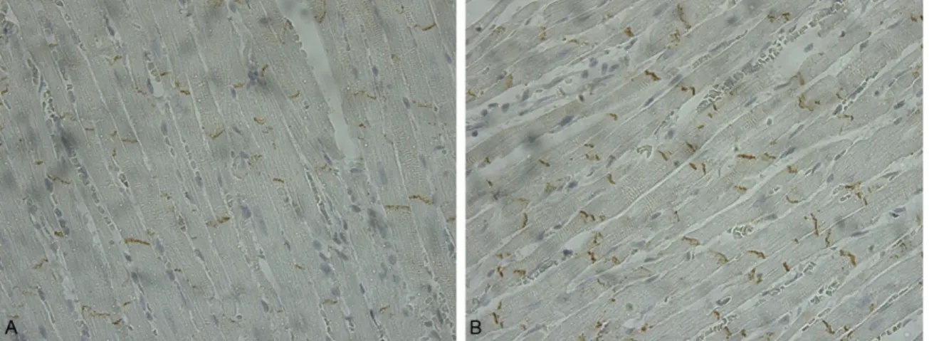 Figure 1. Immunostained connexin43 observed at the intercalated disks in a section taken from the left ventricle of  a LFN-exposed rat (A) and control rat (B) (x 400).