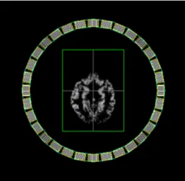 Figure 4.2: Transaxial view of the Hoffman Brain Phantom obtained with GATE’s visualisation tool