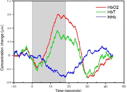 Figure 1.8: Typical NIR signal in result of functional brain activation, showing the con- con-centration change of oxyhaemoglobin, deoxyhaemoglobin and HbT