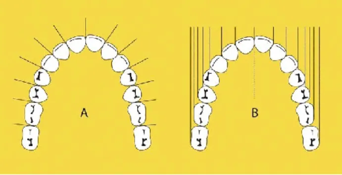 Figura 1 - Larguras reais (A) versus larguras aparentes (B) (Adaptada de Pitel, Raley-Susman, &amp; 