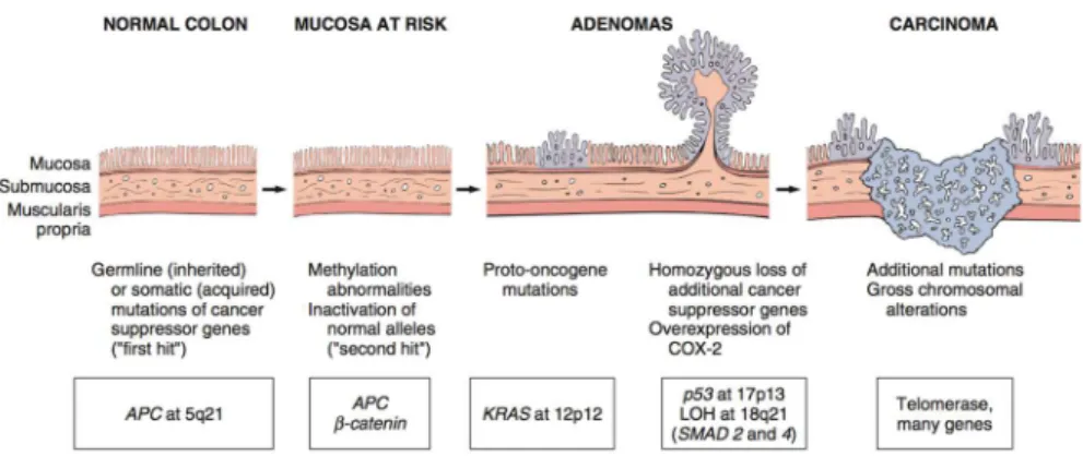 Figura 6- Sequência de alterações morfológicas e moleculares no carcinoma do cólon 