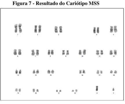 Figura 7 - Resultado do Cariótipo MSS 