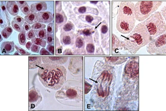 Fig. 6. Photomicrographs of Allium cepa meriste- meriste-matic cells representing more common chromosomal alterations caused by marinobufagin after 72 h of exposure